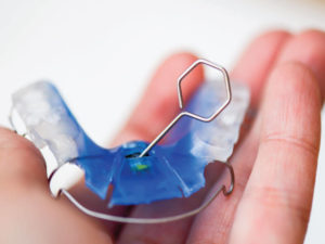 Dentist in Baton Rouge When You Can Stop Wearing Your Retainer
