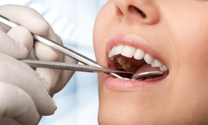 Dentist in Baton Rouge Should You Have Your Wisdom Teeth Removed?