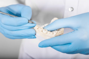 Dentist in Baton Rouge How to Know When You Need a Root Canal