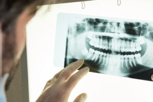 Dentist in Baton Rouge Using Tooth Extraction to Improve your smile and remove pain